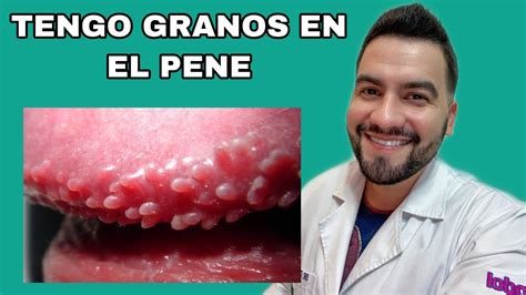 granos en la punta del pene|Enfermedades piel pene